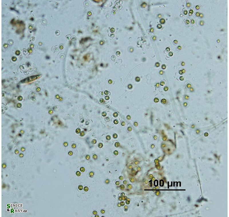 Schizochlamys gelatinosa