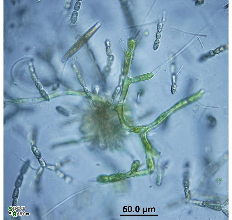 Aphanochaete sp.