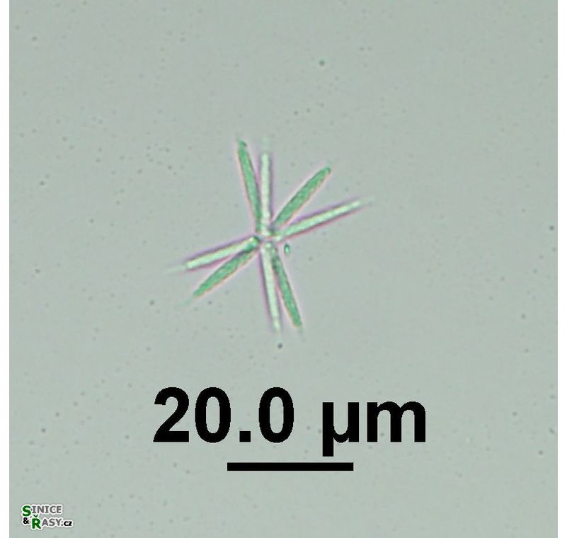 Actinastrum hantzschii