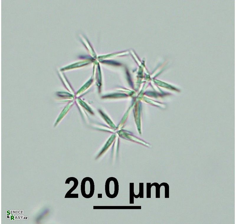 Actinastrum hantzschii