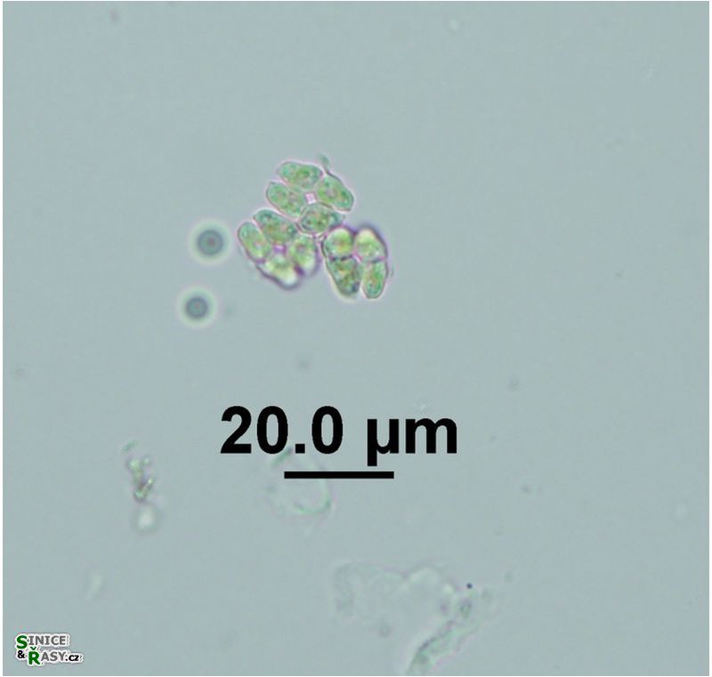 Crucigeniella pulchra