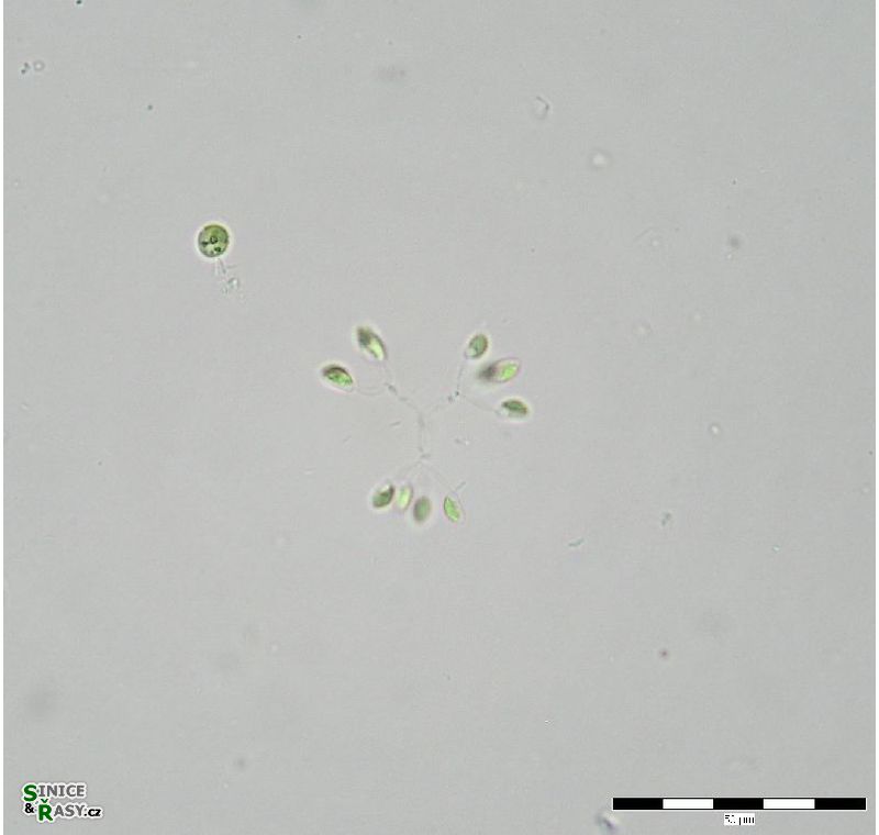 Mucidosphaerium sphagnale