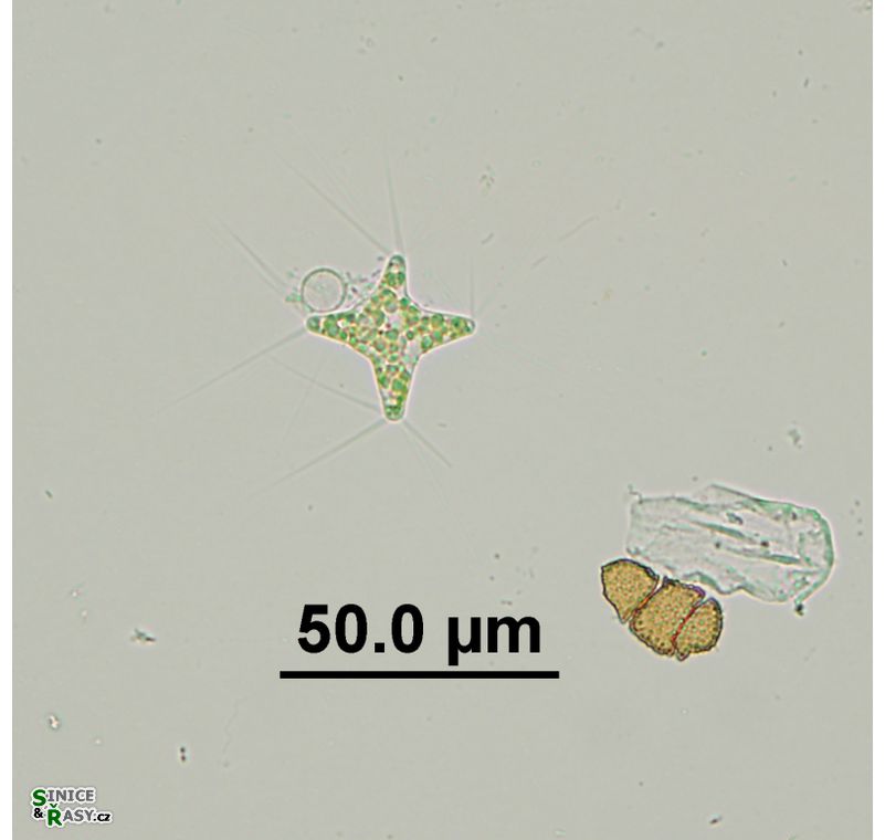 Polyedriopsis spinulosa
