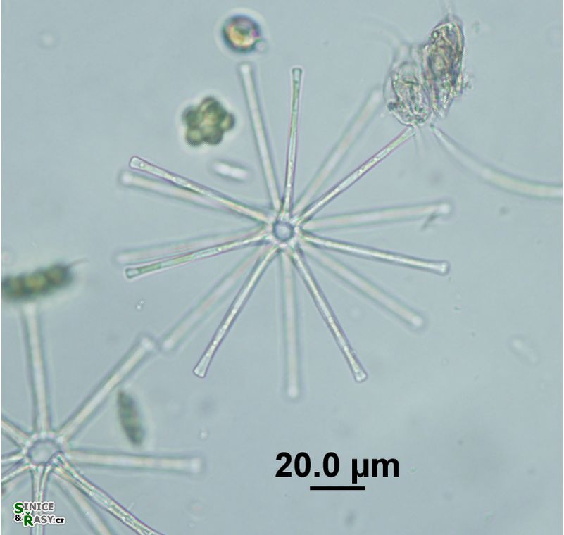 Asterionella formosa