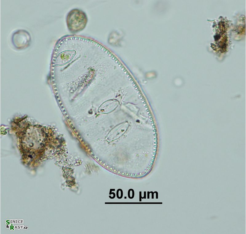 Cymatopleura elliptica