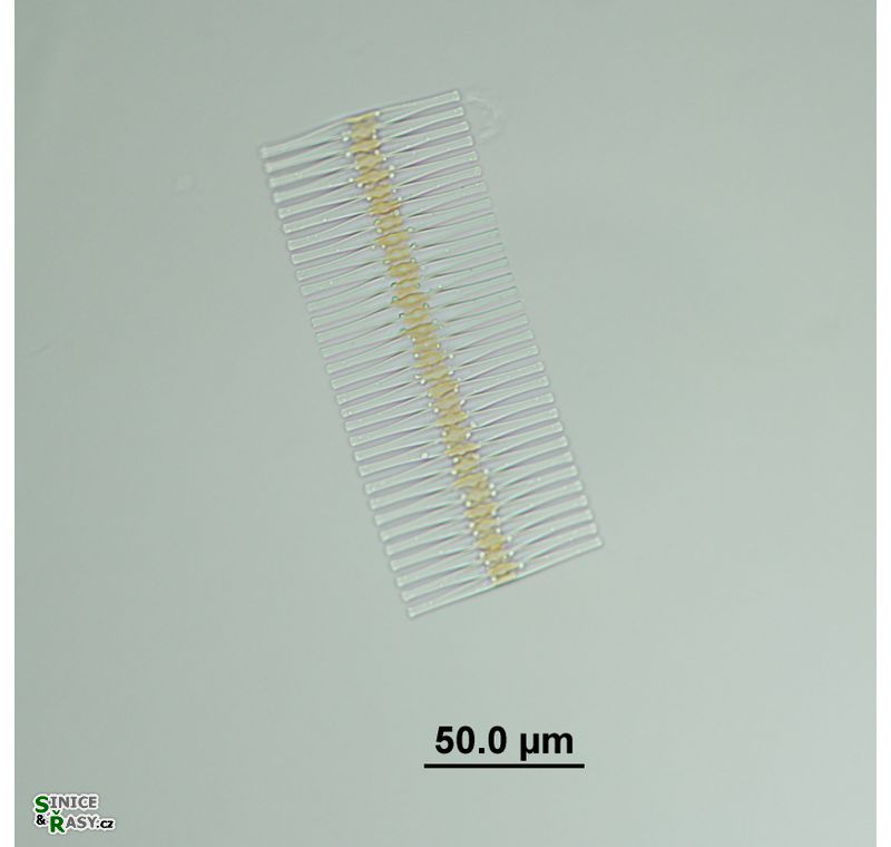 Fragilaria crotonensis