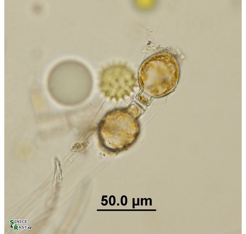 Melosira varians