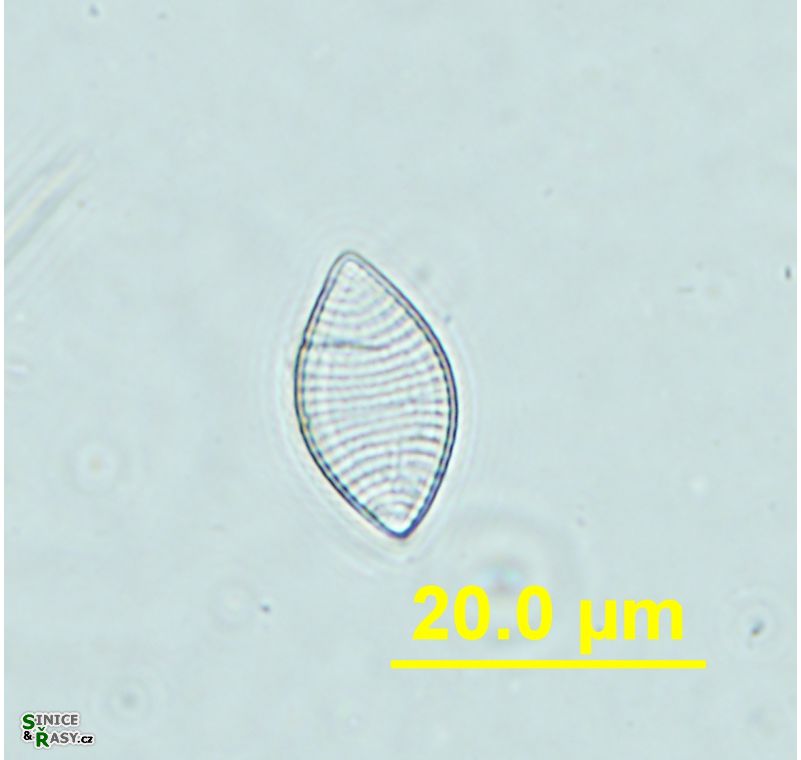 Nitzschia separanda