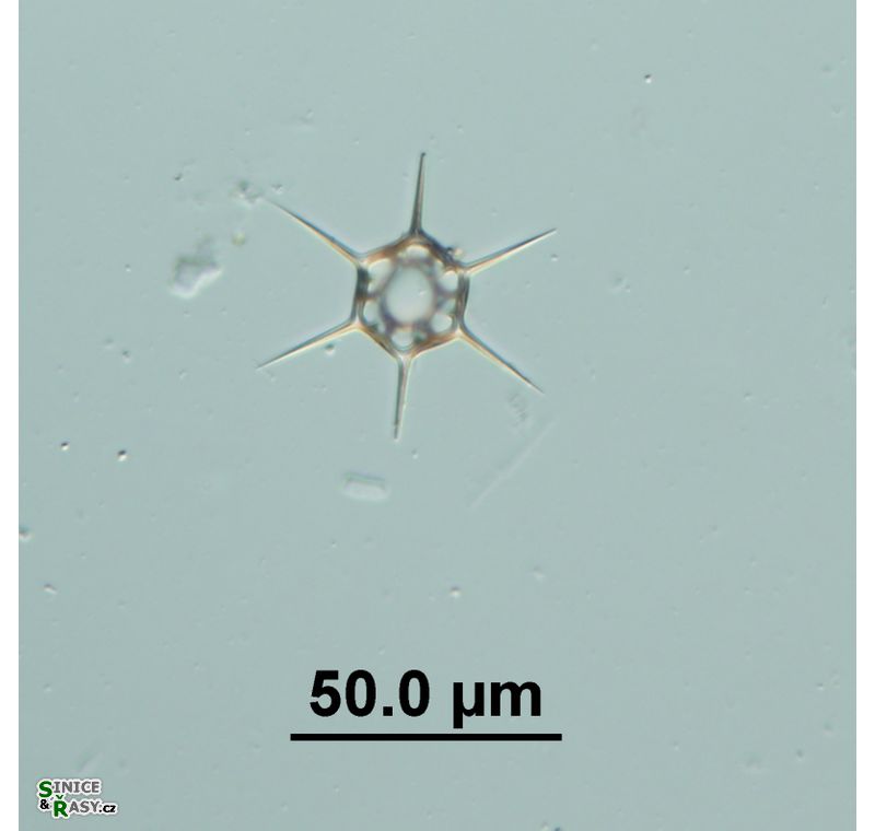 Dictyocha speculum