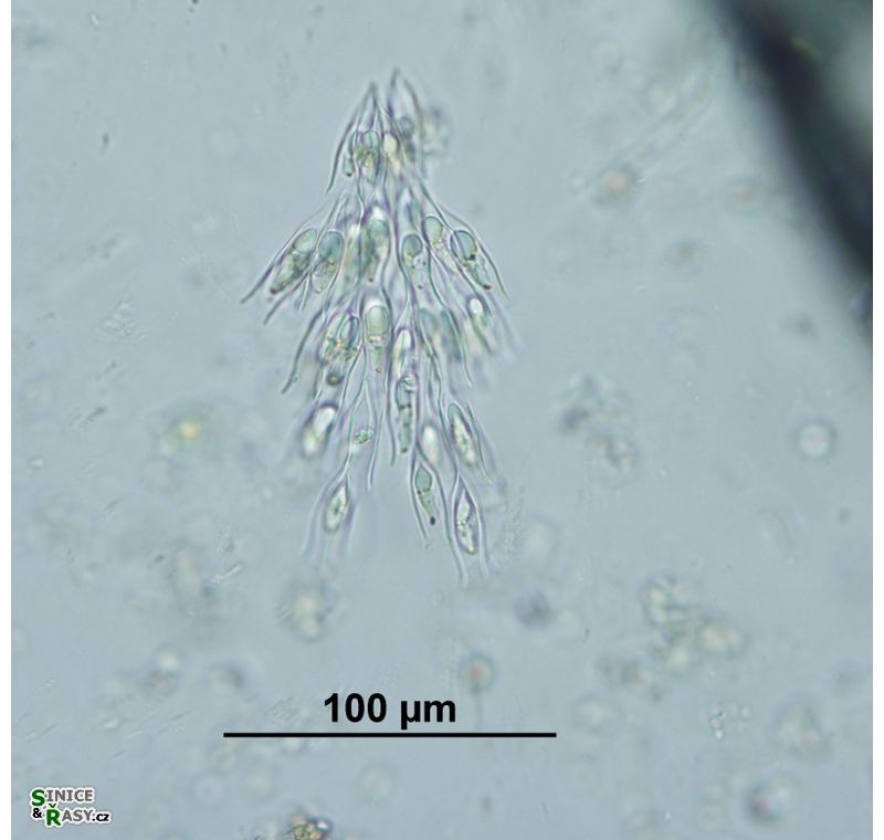 Dinobryon sertularia