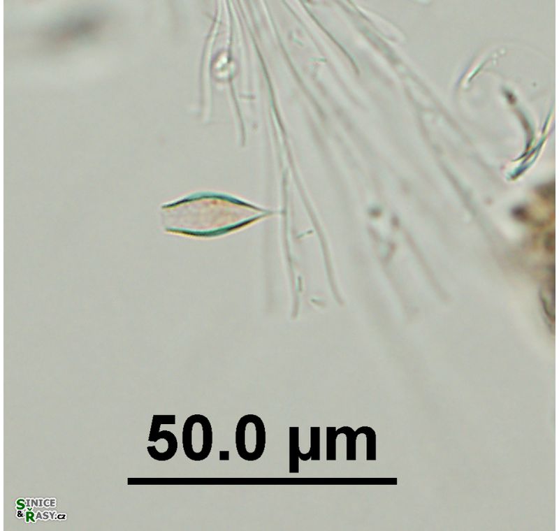 Epipyxis utriculus