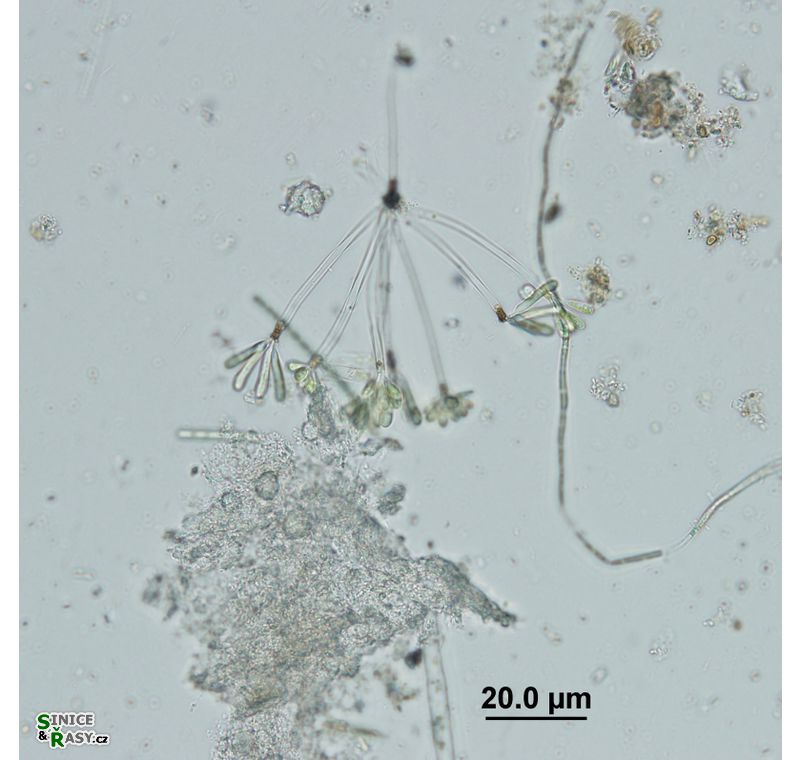 Ophiocytium arbuscula