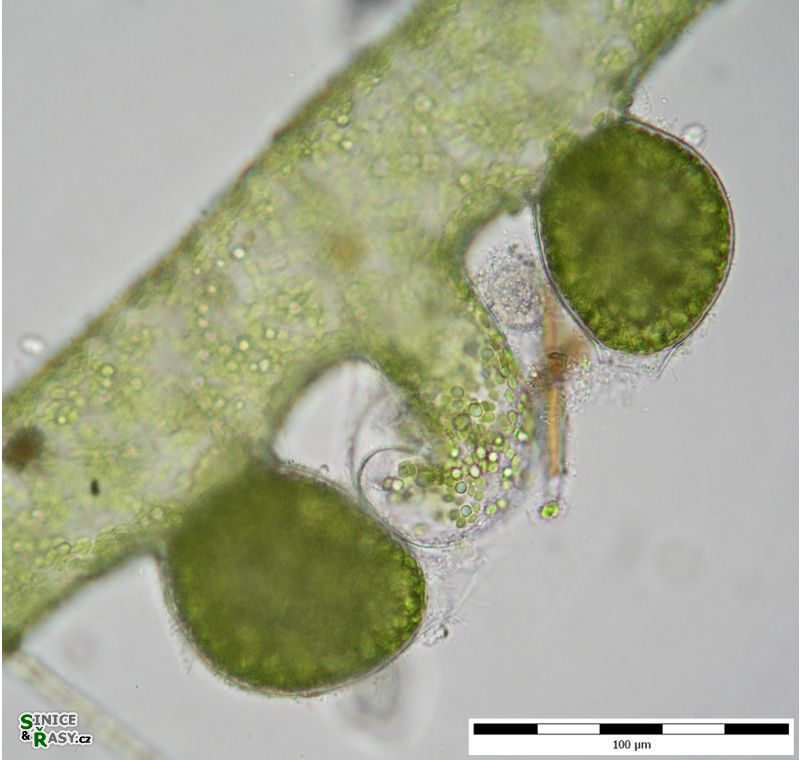 Vaucheria sessilis