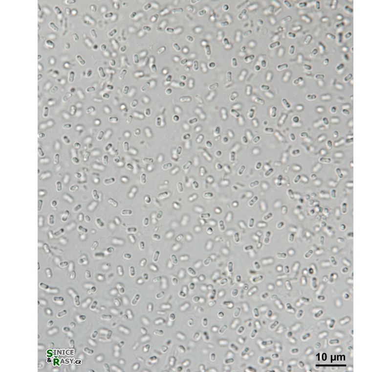 Gloeobacter violaceus