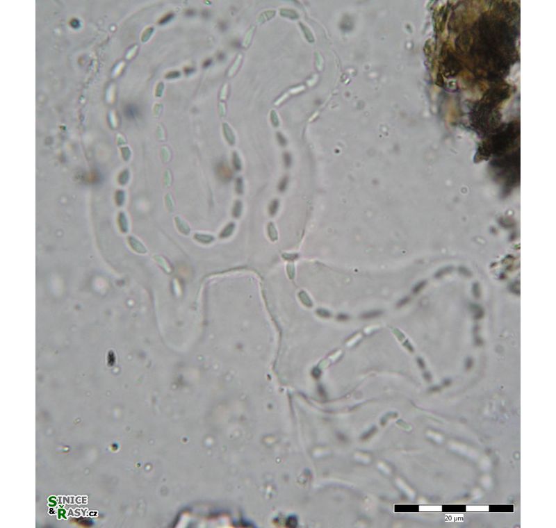Cyanodictyon