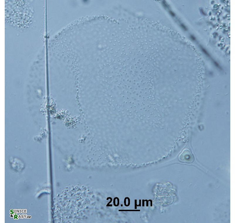 Lemmermanniella parva