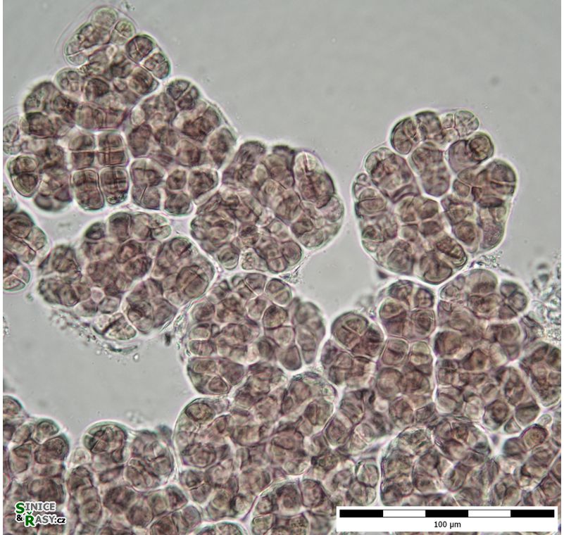 Myxosarcina 