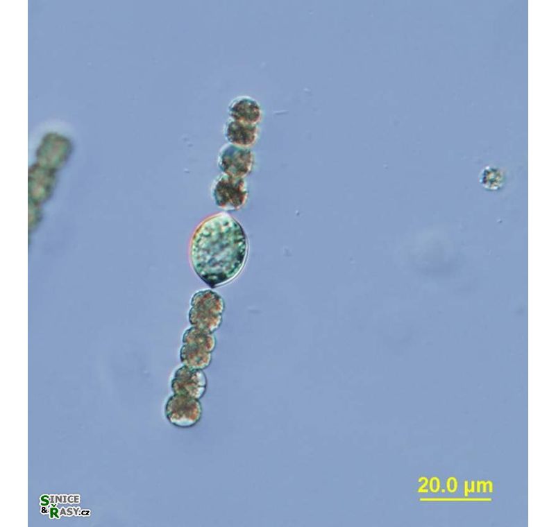 Dolichospermum planctonicum