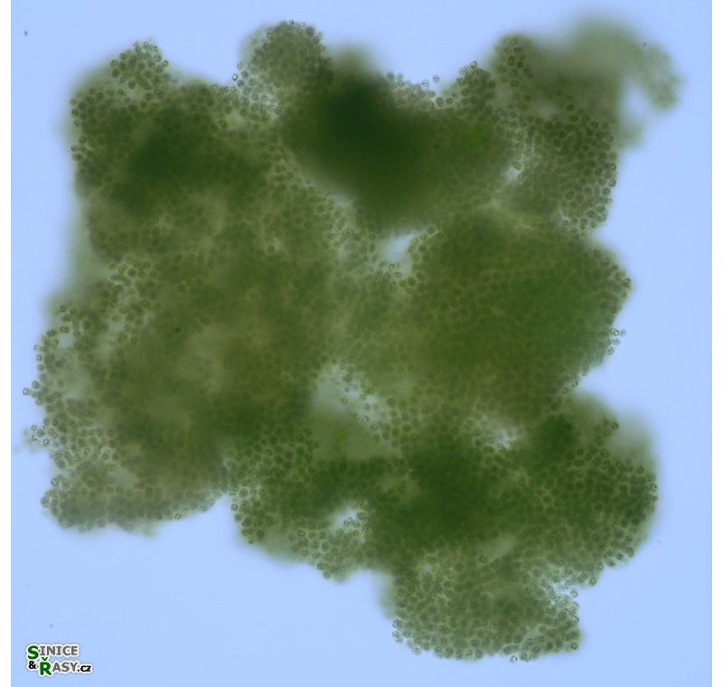 Microcystis ichyoblabe
