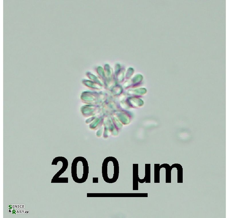 Snowella lacustris 