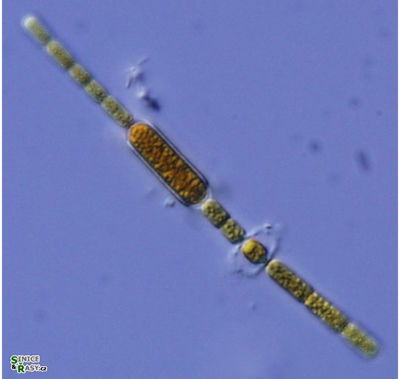 Aphanizomenon gracile