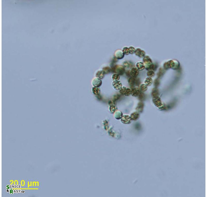 Dolichospermum flos-aquae