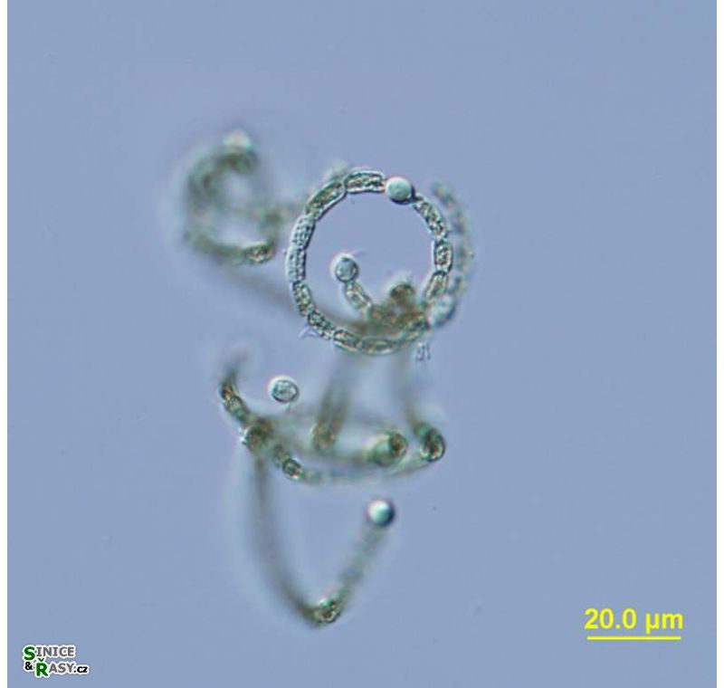 Dolichospermum mendotae