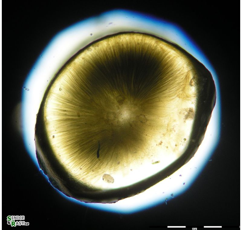 Gloeotrichia intermedia