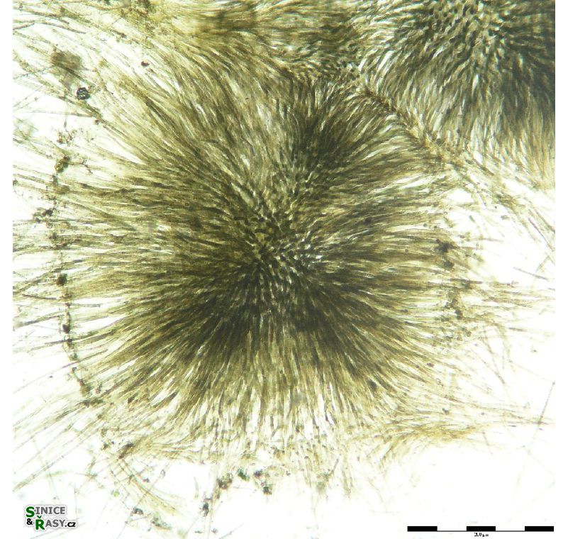 Gloeotrichia intermedia