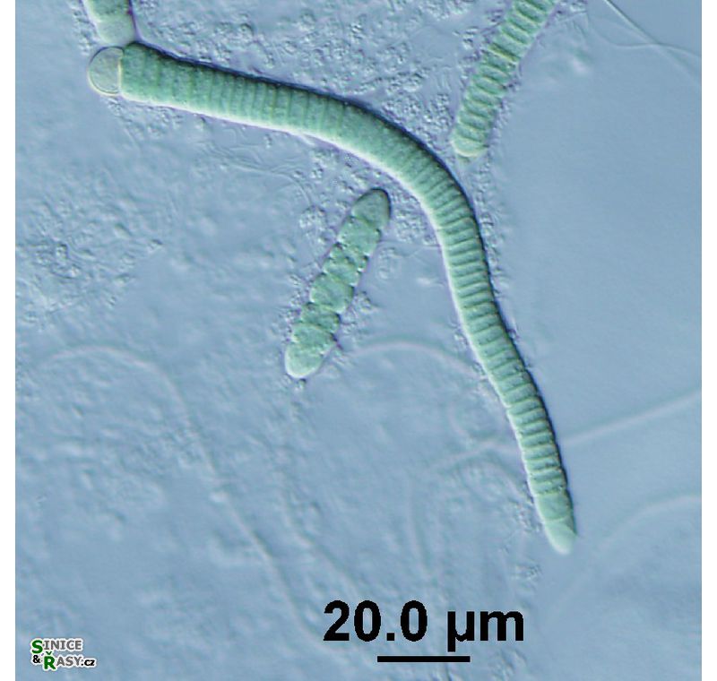 Microchaete sp.
