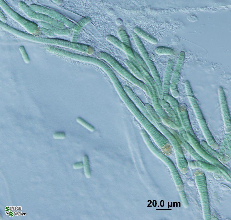 Microchaete sp.