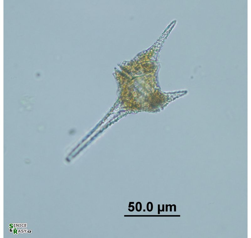 Ceratium hirundinella