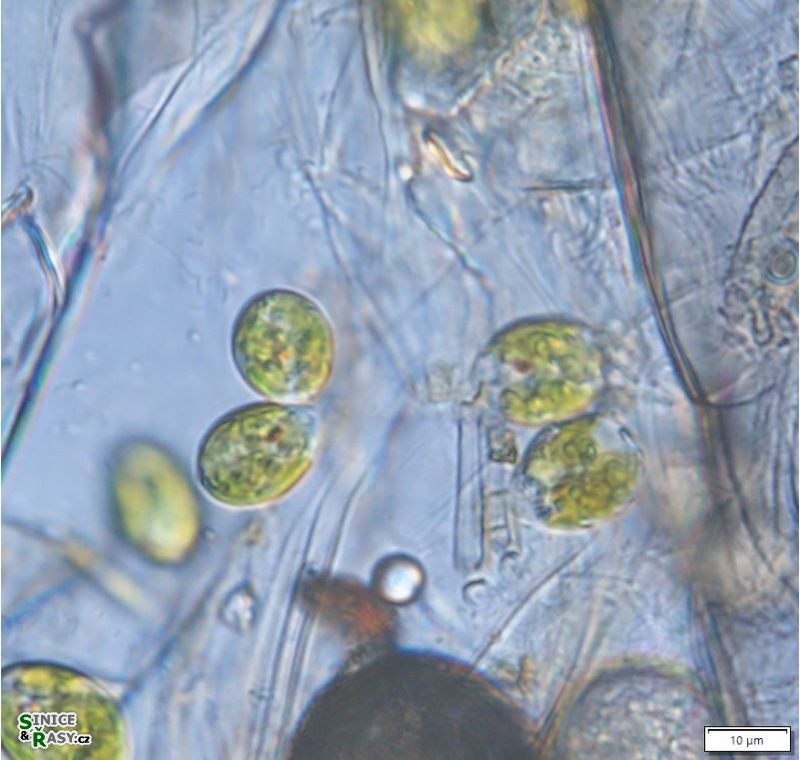 Colacium cyclopicola