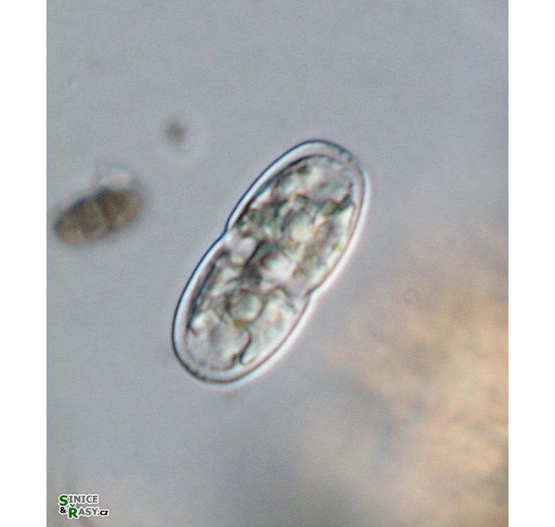 Actinotaenium kriegeri