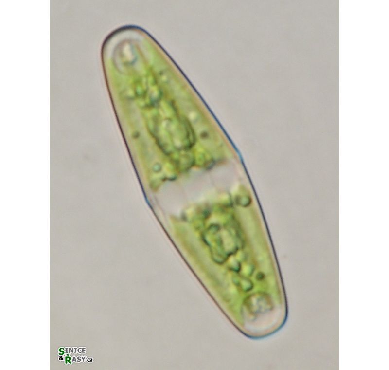 Closterium navicula