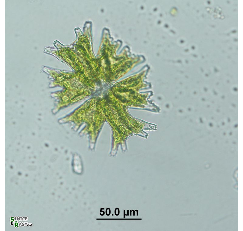 Micrasterias americana