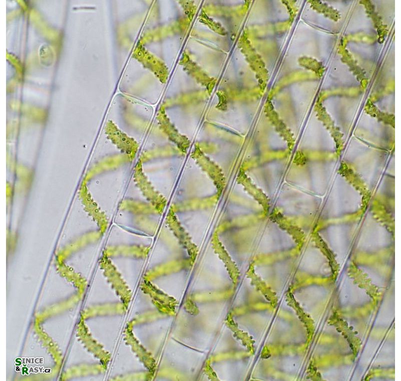 Spirogyra
