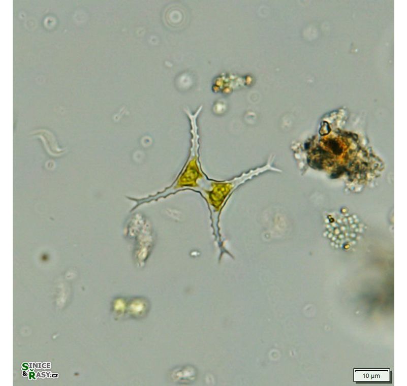 Staurastrum bloklandiae