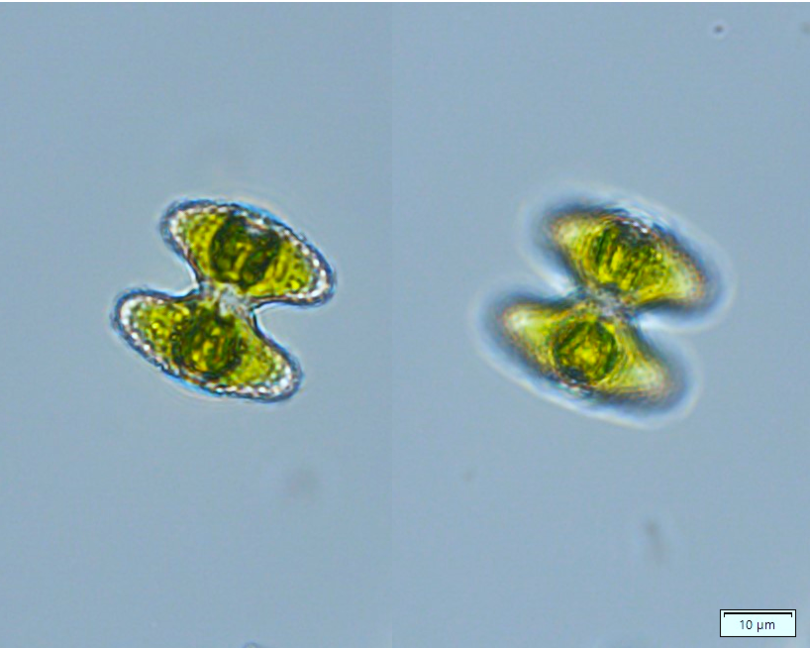 Staurastrum striolatum