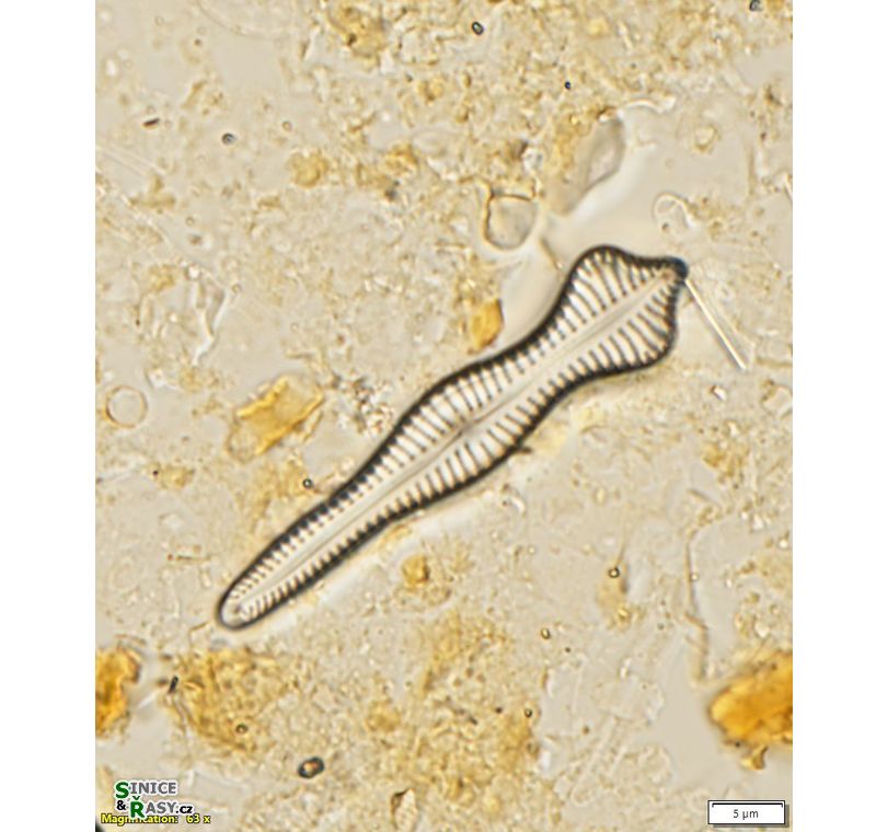 Gomphonema coronatum