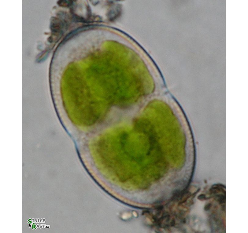 Actinotaenium
