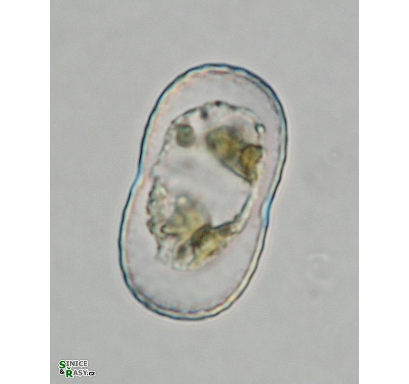 Actinotaenium trachypolum
