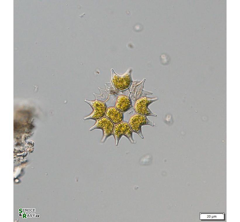 Pseudopediastrum boryanum