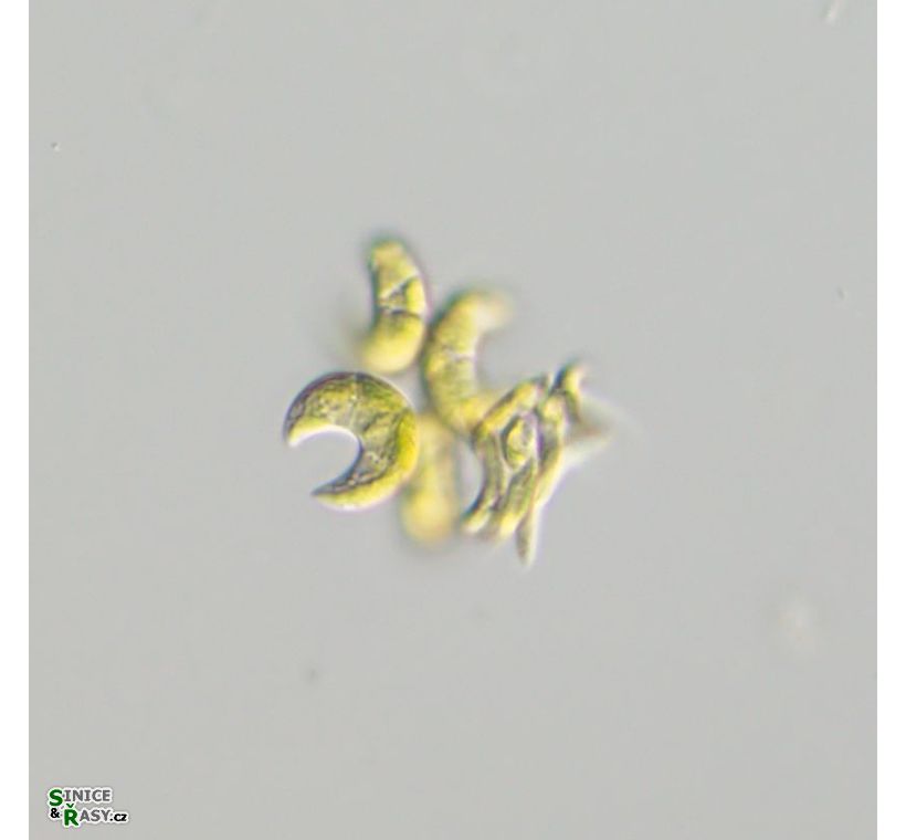 Selenastrum bibraianum