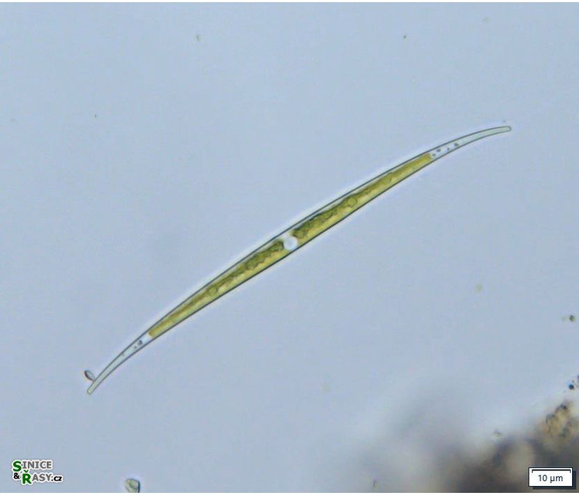 Closterium subulatum