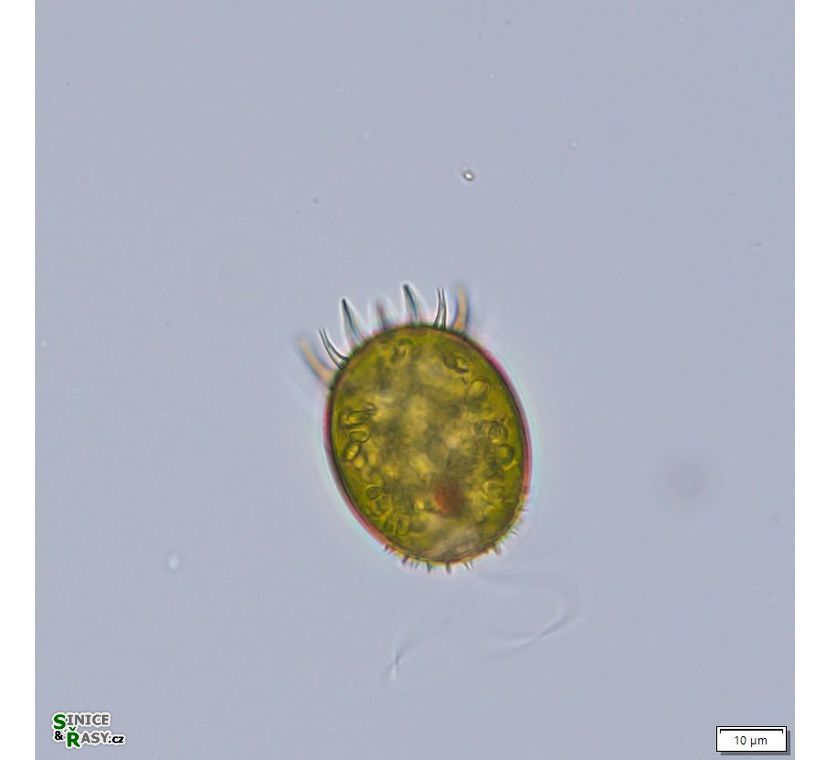 Trachelomonas armata