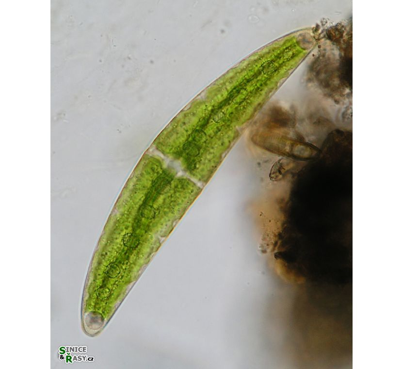 Closterium