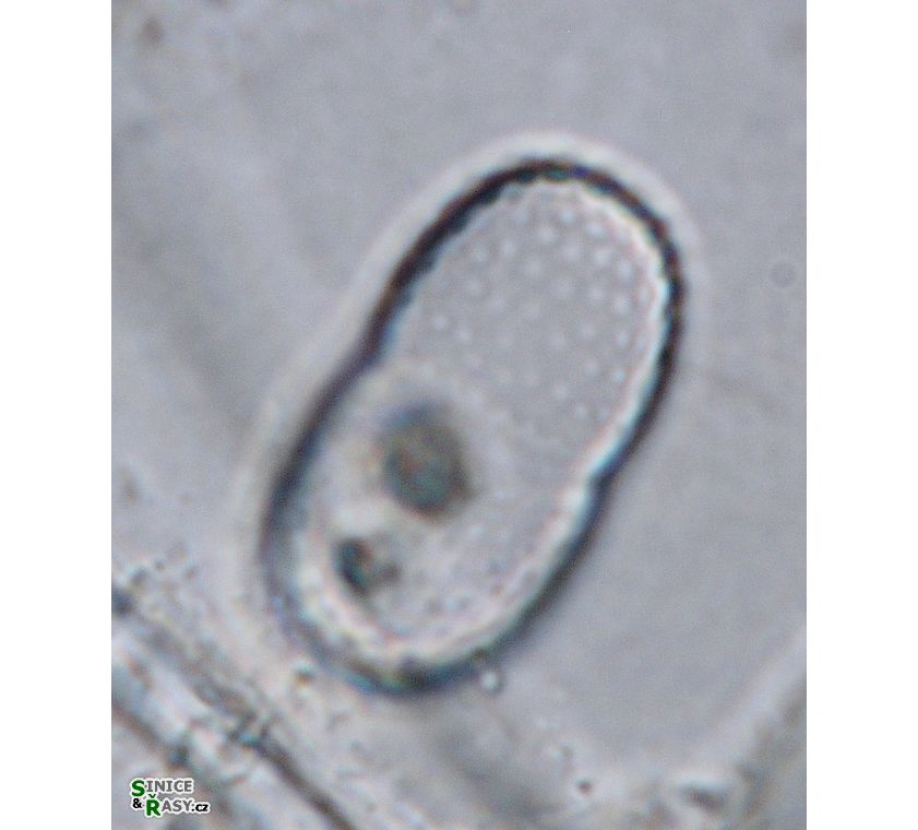 Actinotaenium trachypolum