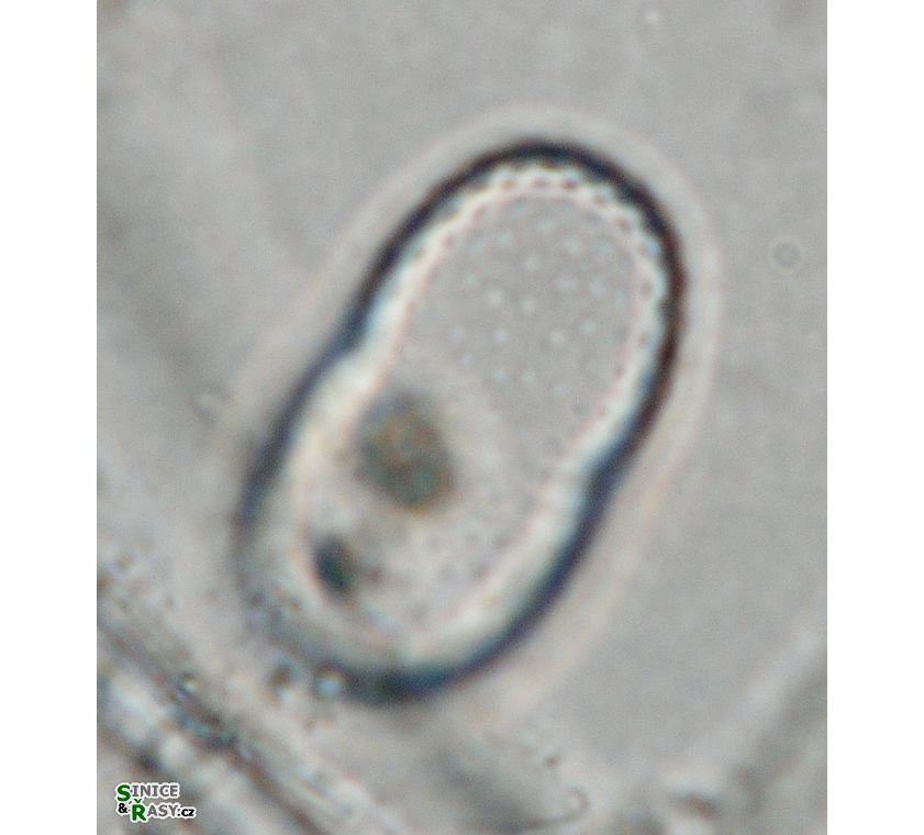 Actinotaenium trachypolum