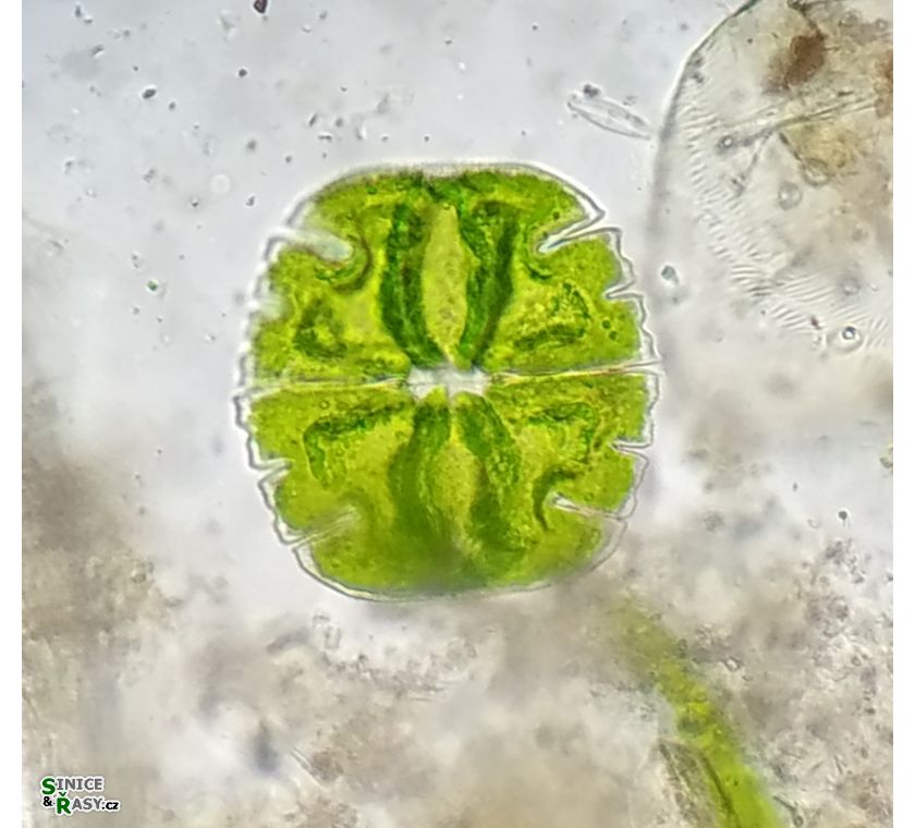 Micrasterias truncata